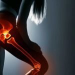 Hip Pain and Hormone Levels